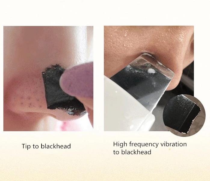 A - Ultrasonic Facial scrubber face spatula Spa cleansing device black head remover